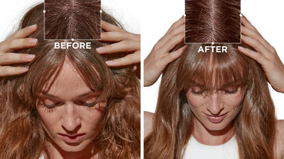 Discover the Best Traitement Cheveux for Healthier, Stronger Hair