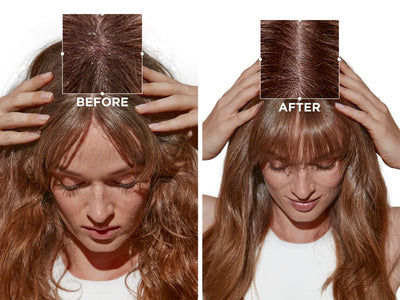 The Best Apres Shampooing Treatments for Healthy Hair