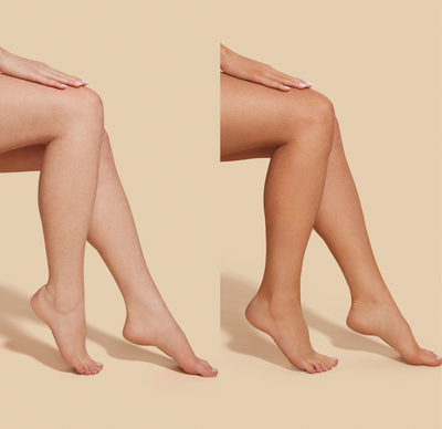 Before and after comparison of legs using self tanning mousse, showcasing a natural medium tan effect.