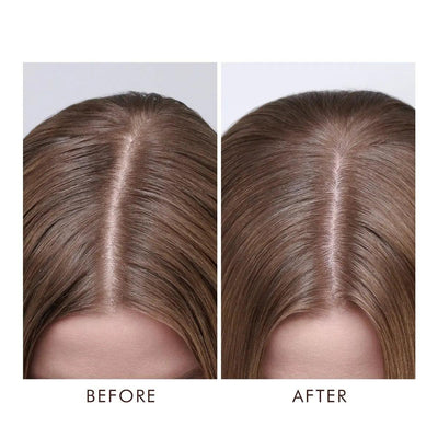 Before and after results of Moroccanoil Dry-No-More Scalp Treatment showing improved scalp moisture and revitalized hair.
