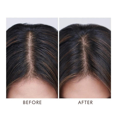 Before and after image showing improved scalp appearance after using Oily Scalp Treatment for excess oil control.
