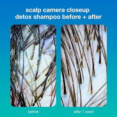 Scalp closeup showing before and after results of using PEPTIDE PREP™ Detox Shampoo. Noticeable removal of buildup after one wash.