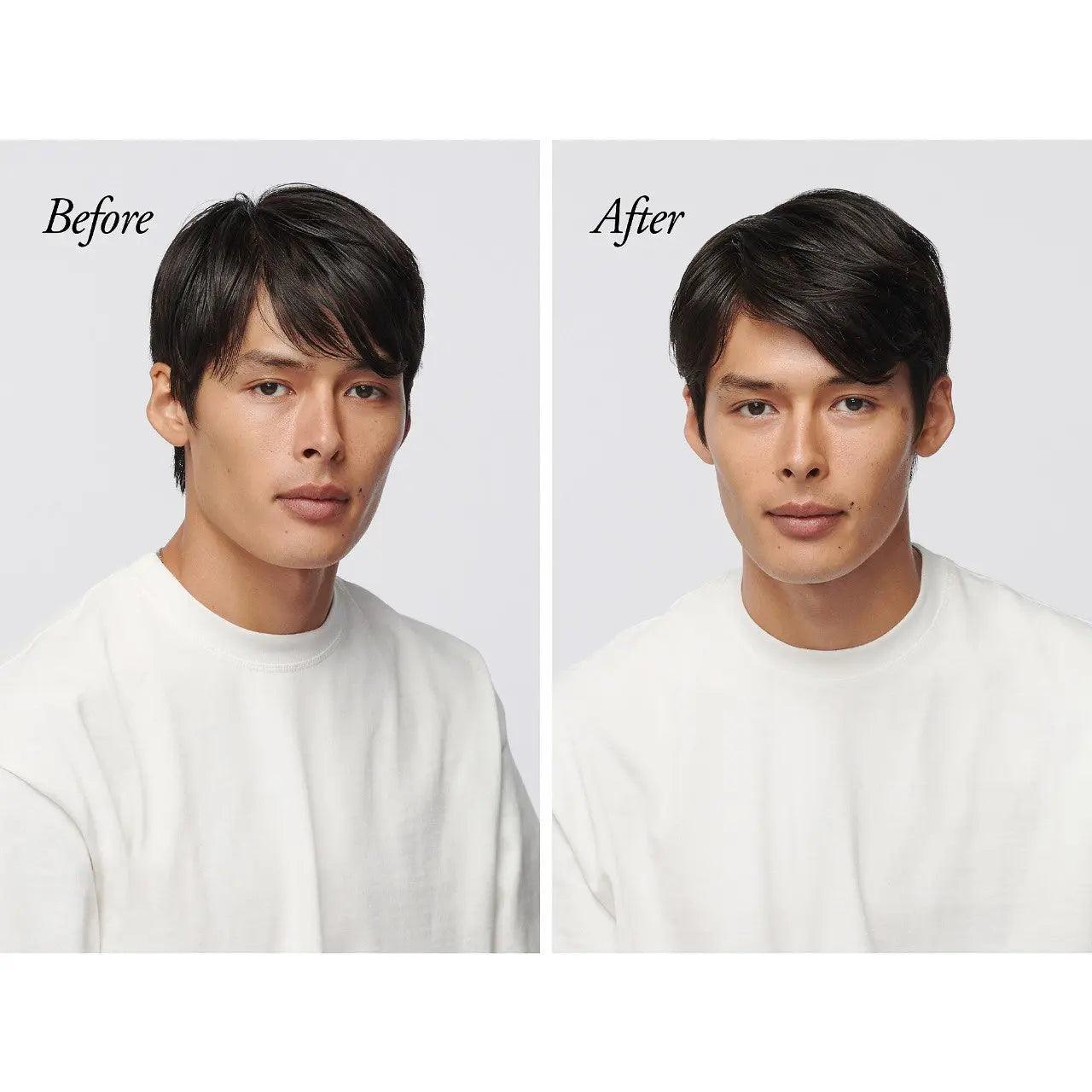 Before and after transformation showing improved hair health and appearance on a man using Serene Scalp Oil Control Shampoo.