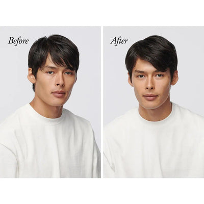 Before and after transformation showing improved hair health and appearance on a man using Serene Scalp Oil Control Shampoo.