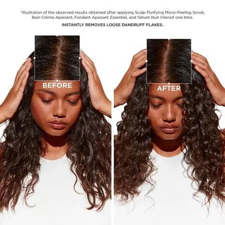 Before and after results showing the effectiveness of Kerastase Scalp Purifying Micro-Peeling and Fondant Apaisant Essentiel.